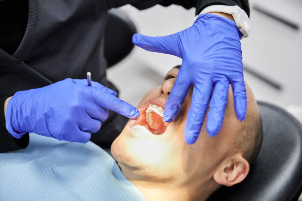 Best Emergency Dentist for Knocked-Out Tooth in East Los Angeles, CA
