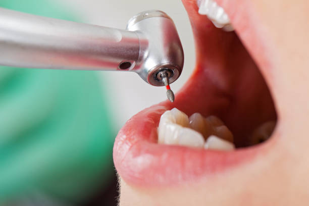 Best Pediatric Emergency Dentist in East Los Angeles, CA